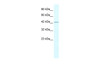 Antibody used in WB on Human HepG2 at 0.2-1 ug/ml.