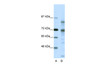 Antibody used in WB on Human HeLa at 0.2-1 ug/ml.