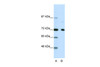 Antibody used in WB on Human HeLa at 2.5 ug/ml.
