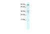 Antibody used in WB on Human Liver at 4 ug/ml.