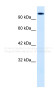 Antibody used in WB on Human HepG2 at 0.06 ug/ml.