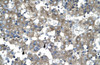 Antibody used in IHC on Human Liver.