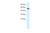 Antibody used in WB on Human HepG2 at 0.2-1 ug/ml.