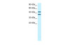 Antibody used in WB on Human HepG2 at 0.3-0.5 ug/ml.