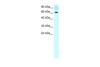 Antibody used in WB on Human HepG2 at 2.0 ug/ml.