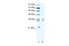 Antibody used in WB on Human Jurkat 1.25 ug/ml.