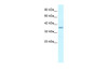 Antibody used in WB on Human heart at 0.2-1 ug/ml.