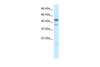 Antibody used in WB on Human Jurkat 2.5 ug/ml.