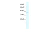 Antibody used in WB on Human HepG2 at 0.2-1 ug/ml.