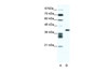 Antibody used in WB on Human Jurkat 0.2-1 ug/ml.