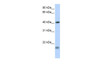 Antibody used in WB on Human Jurkat 0.2-1 ug/ml.