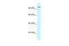 Antibody used in WB on Human Jurkat cells at 1.25 ug/ml.