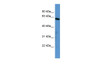 Antibody used in WB on Human HepG2 at 0.25 ug/ml.