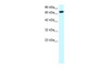 Antibody used in WB on Human Jurkat 1.25 ug/ml.