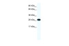 Antibody used in WB on Human Jurkat 0.2-1 ug/ml.