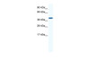 Antibody used in WB on Human Placenta at 0.2-1 ug/ml.