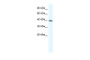 Antibody used in WB on Human Jurkat 0.2-1 ug/ml.