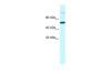 Antibody used in WB on Human HepG2 at 1.25 ug/ml.