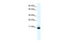 Antibody used in WB on Human Lung at 0.2-1 ug/ml.