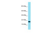 Antibody used in WB on Hela at 1 ug/ml.