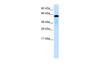 Antibody used in WB on Human Liver at 0.2-1 ug/ml.