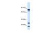 Antibody used in WB on Human kidney at 0.2-1 ug/ml.