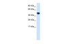 Antibody used in WB on Human Lung at 0.2-1 ug/ml.