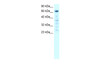 Antibody used in WB on Human HepG2 at 0.2-1 ug/ml.