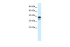 Antibody used in WB on Human Daudi at 1.25 ug/ml.