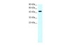 Antibody used in WB on Human Jurkat 0.2-1 ug/ml.