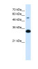 Antibody used in WB on Human Fetal Liver at 0.1 ug/ml.