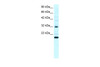 Antibody used in WB on Human Daudi at 0.2-1 ug/ml.
