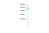 Antibody used in WB on Human Raji at 0.2-1 ug/ml.