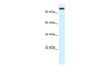 Antibody used in WB on Human HeLa at 0.2-1 ug/ml.