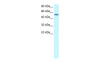 Antibody used in WB on Human HepG2 at 1.25 ug/ml.