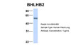 Antibody used in WB on Hum. Fetal Lung at 1 ug/ml.