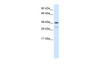 Antibody used in WB on Human Lung at 0.06 ug/ml.