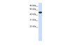 Antibody used in WB on Human Jurkat 0.5 ug/ml.