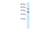 Antibody used in WB on Human Jurkat 0.2-1 ug/ml.