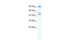 Antibody used in WB on Human Jurkat cells at 0.2-1 ug/ml.