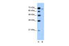 Antibody used in WB on Human HepG2 cells at 1.25 ug/ml.