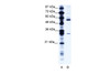 Antibody used in WB on Human Jurkat 1.25 ug/ml.