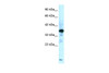 Antibody used in WB on Human Muscle at 0.2-1 ug/ml.