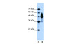 Antibody used in WB on Human Small Intestine at 0.03 ug/ml.