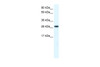 Antibody used in WB on Human Muscle at 0.1 ug/ml.