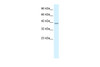 Antibody used in WB on Human HepG2 at 1.25 ug/ml.