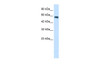 Antibody used in WB on Human Jurkat 1.25 ug/ml.