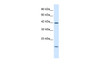 Antibody used in WB on Human Jurkat cells at 1.25 ug/ml.