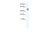 Antibody used in WB on Human Placenta at 0.2-1 ug/ml.