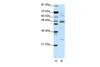 Antibody used in WB on Human Jurkat cells at 5.0 ug/ml.